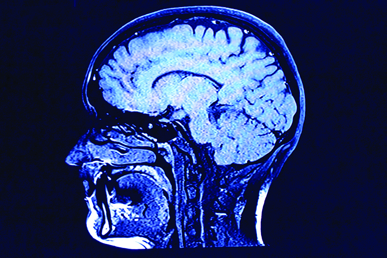 Brain