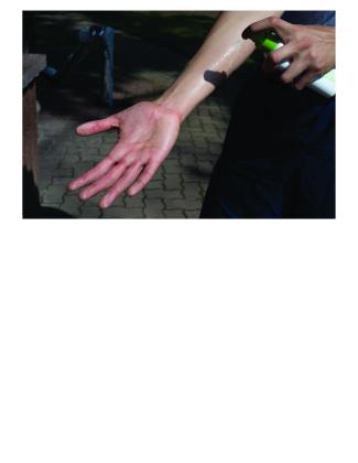 Avoid Bug Bites